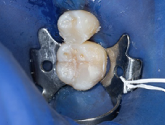 Blog_Halo_Clinical_Guide_DrRichins_7