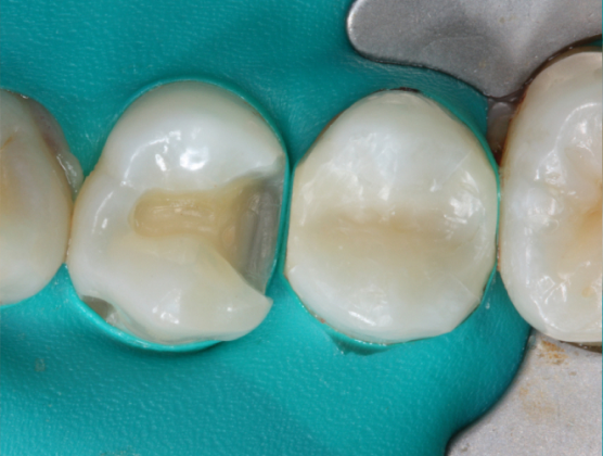 Blog_Halo_Clinical_Guide_DrWright_2