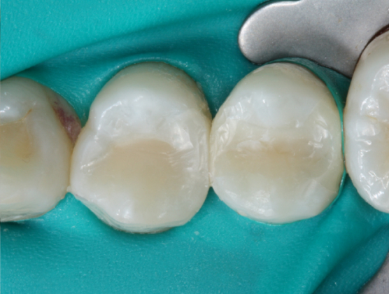 Blog_Halo_Clinical_Guide_DrWright_5