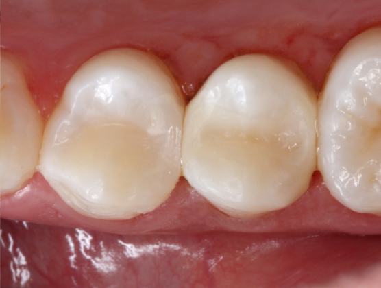 Blog_Halo_Clinical_Guide_DrWright_6
