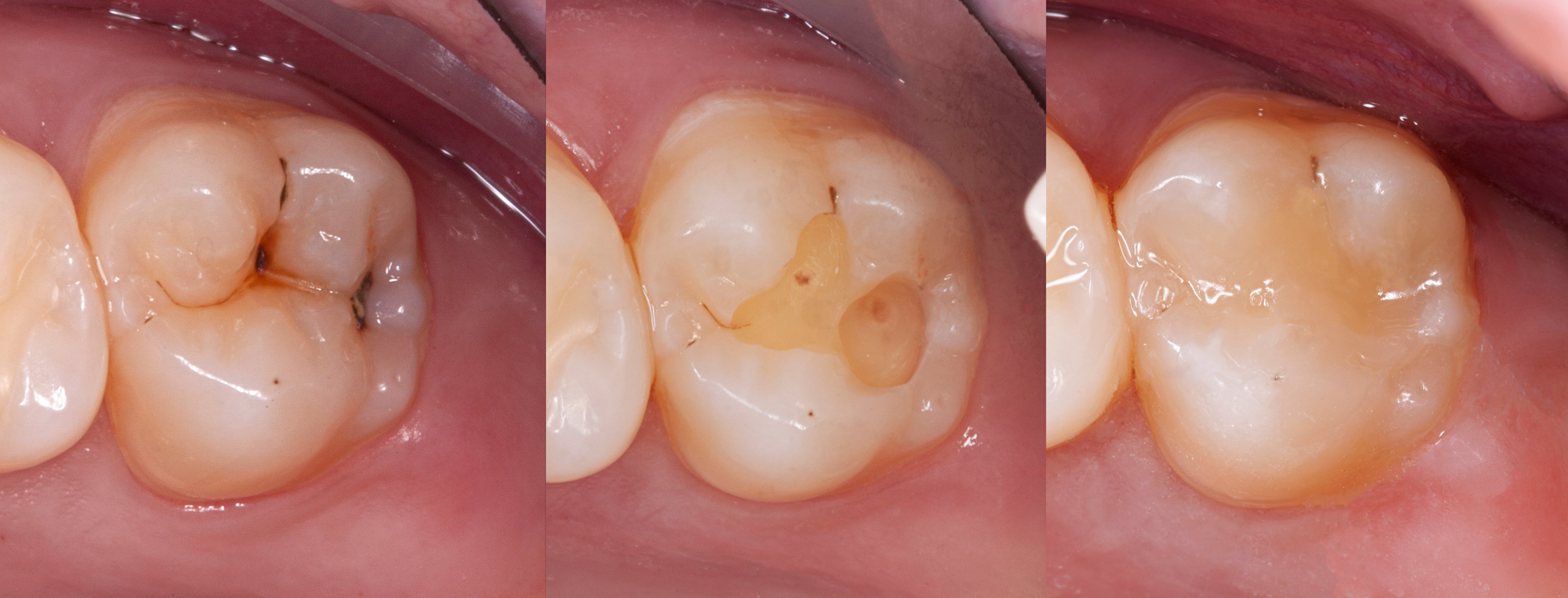 Clinical_Transcend_Jasmine_Dr.Findley_07_14_21