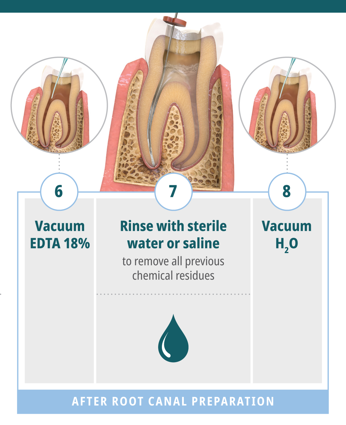 Clinical Guide Endodontic Irrigation Protocol