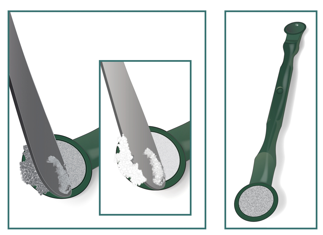 A Simple Guide to Easy Endo Repairs with Endo-Eze™ MTAFlow™ Cement