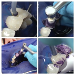 opalustre process