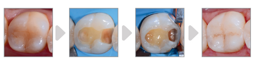 composite-handling-mosaic_case-studies