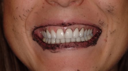 A picture containing person, mouth, teeth, person
Description automatically generated